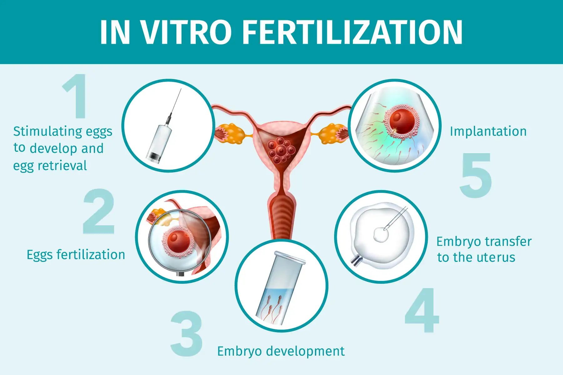 ivf steps